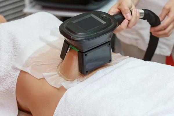Image of person having fat freezing treatment to help weight gain Tong