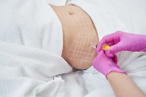 image of fat dissolving injections on love handles to help combat weight gain Tong